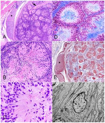 Case Report: Neuroblastoma-Like Schwannoma in a Domestic Short-Haired Cat